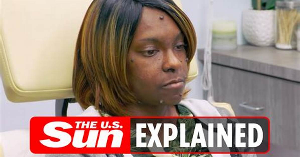 What Happened to Brittney Sharp on Dr Pimple Popper? Brittany Sharp Cause of Death Explained