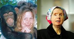 What Happened to Charla Nash? Woman Had to Undergo Face Transplant Surgery After Chimp Attack