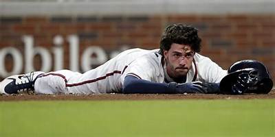 What Happened to Dansby Swanson Eyebrow? Everything We Know on His Injury and More