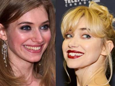 What Happened to Imogen Poots Teeth? Explore Her Eye Color and Hair Transformation