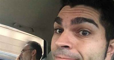 What Happened to Jason Rantz Eye? Eyebrows and Health Update
