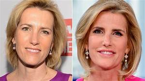 What Happened to Laura Ingraham Face? Face Lift and Plastic Surgery Update