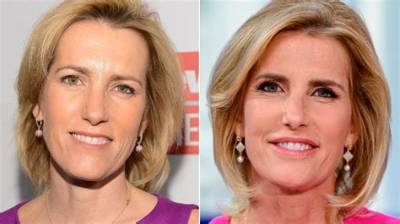 What Happened to Laura Ingraham Face? Face Lift and Plastic Surgery Update