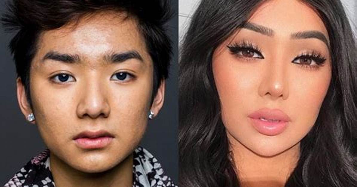 What Happened to Nikita Dragun? Before and After Surgery