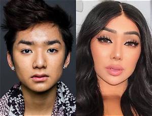What Happened to Nikita Dragun? Before and After Surgery