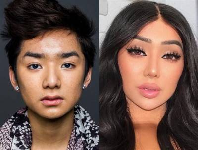 What Happened to Nikita Dragun? Before and After Surgery