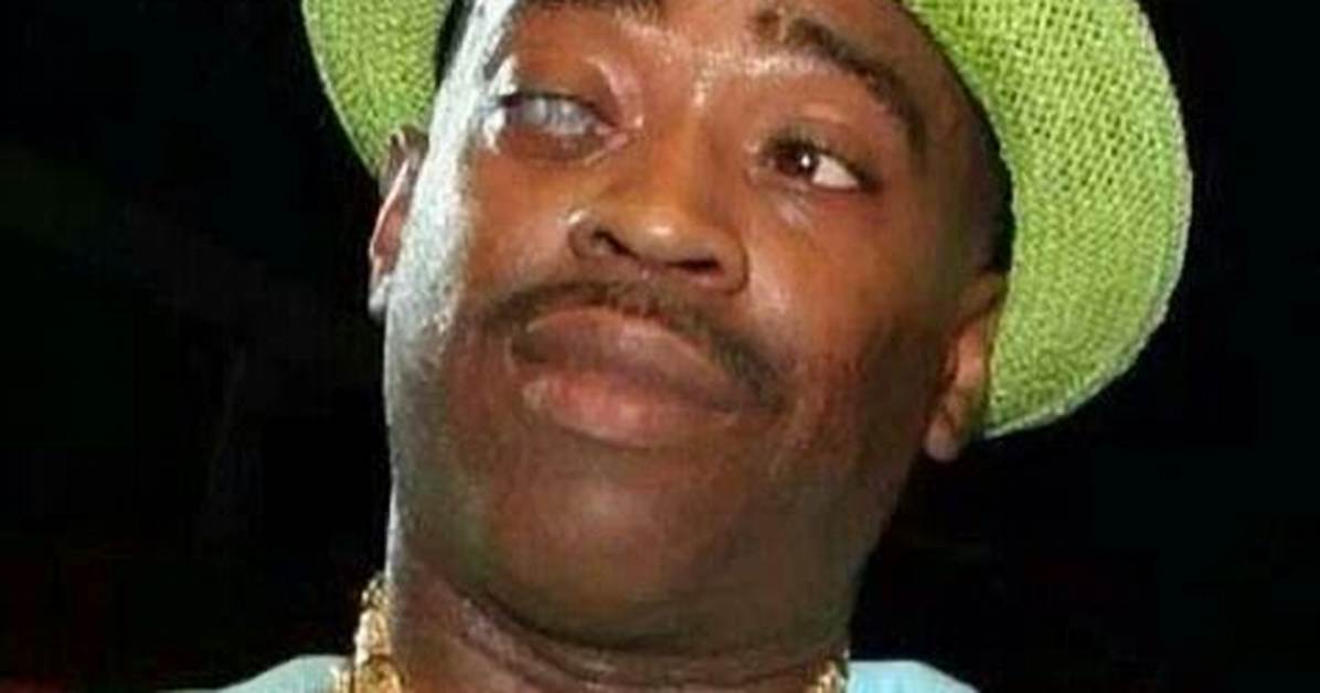What Happened to Slick Rick Eye, Why Does He Wear Eye Patch?