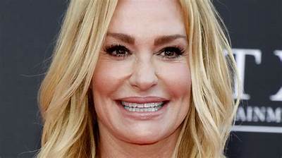 What Happened to Taylor Armstrong Face? ‘Real Housewives of Beverly Hills’ Star Looks Unrecognizable in New Photos