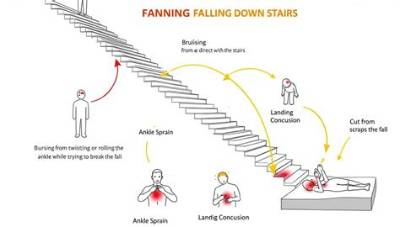 What Happens to a Body Falling from a Building