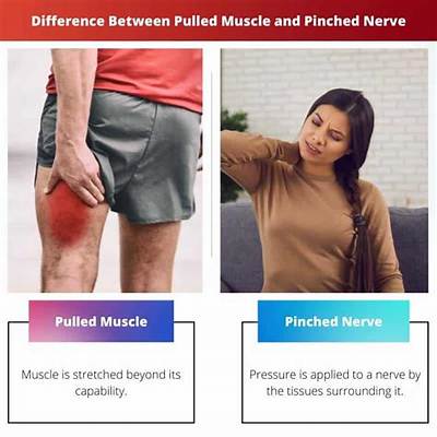 What Is the Difference Between Pinched Nerve and Pulled Muscle
