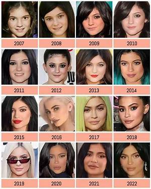 What Plastic Surgery Did Kiaraakitty Had? Before & After Photo on Reddit of the Streamer