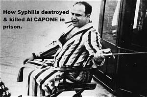 When Did Al Capone Get Syphilis? How Did Al Capone Get Syphilis? Did Capone’s Wife Have Syphilis?