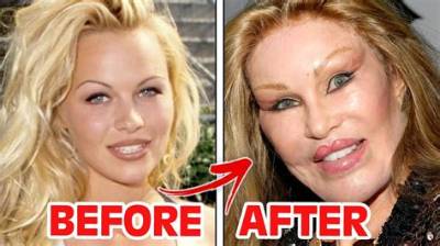 Who Is Alysia Magen? Before Plastic Surgery Photos as Blac Chyna Boxing Match Has a Twist