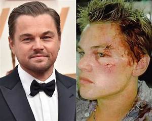 Who Is Aretha Wilson and Where Is Leonardo Dicaprio Attacker Today?