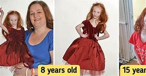 Who Is Charlotte Garside? Is World's Smallest Girl Dead or Alive? Wikipedia Update