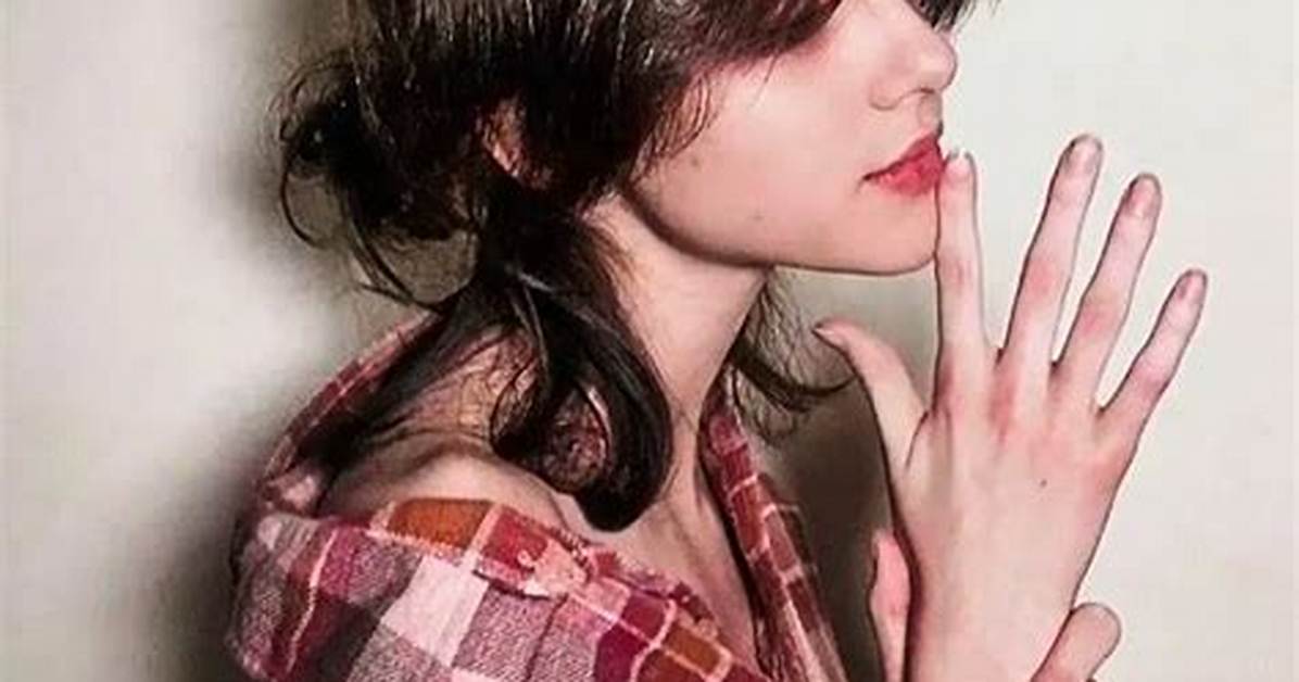 Who Is Rachel Chaleff? Disability & Syndrome Details of the Tiktok Star
