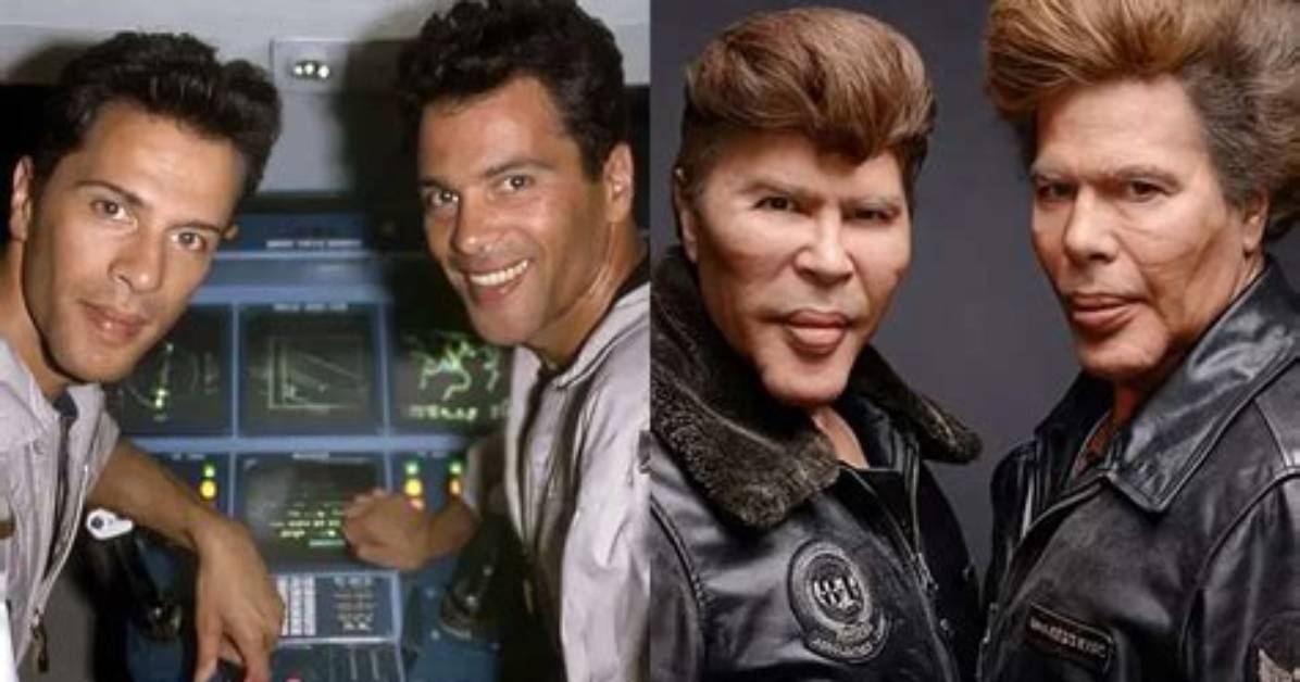 Why Did the Bogdanoff Twins Get Surgery and What Happened to Them? Before & After Pictures