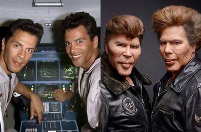 Why Did the Bogdanoff Twins Get Surgery and What Happened to Them? Before & After Pictures