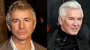 Why Does Baz Luhrmann Look So Different Now? What Has He Done to His Face?