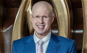 Why Does Tom Allen Have No Hair? New Look and Facial Hair Update