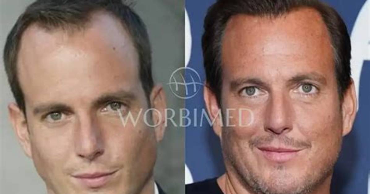 Will Arnett Weight Loss: Before and After Photos