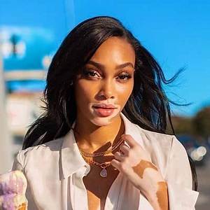 Winnie Harlow (Model) Wiki, Bio, Age, Height, Weight, Boyfriend, Measurements, Net Worth, Family, Facts
