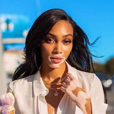 Winnie Harlow (Model) Wiki, Bio, Age, Height, Weight, Boyfriend, Measurements, Net Worth, Family, Facts
